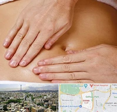 متخصص ناف گیری در گیشا