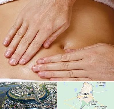 متخصص ناف گیری در بابل