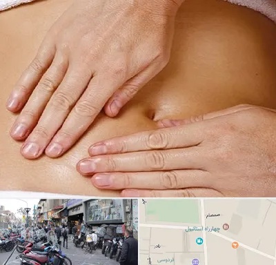متخصص ناف گیری در چهارراه استانبول