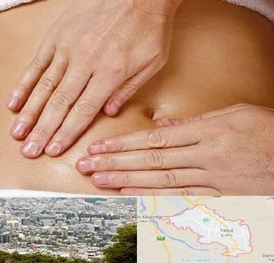 متخصص ناف گیری در یاسوج