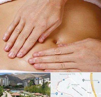 متخصص ناف گیری در شهر زیبا