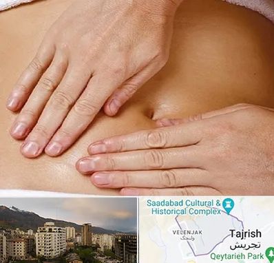 متخصص ناف گیری در زعفرانیه