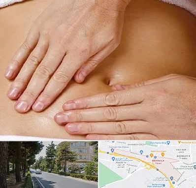 متخصص ناف گیری در مهرویلا کرج