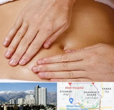 متخصص ناف گیری در شهرک غرب