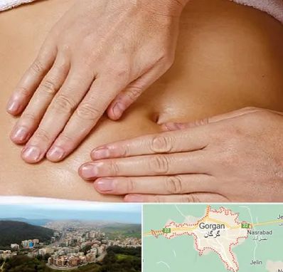 متخصص ناف گیری در گرگان