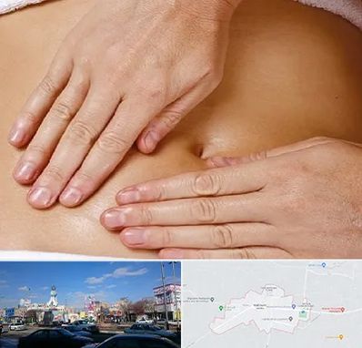 متخصص ناف گیری در ماهدشت کرج