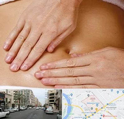 متخصص ناف گیری در زیتون کارمندی اهواز