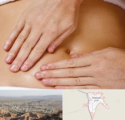 متخصص ناف گیری در اسفراین