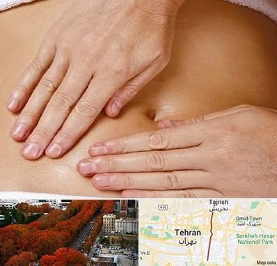 متخصص ناف گیری در ولیعصر