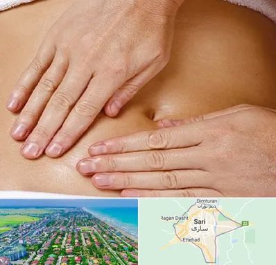 متخصص ناف گیری در ساری