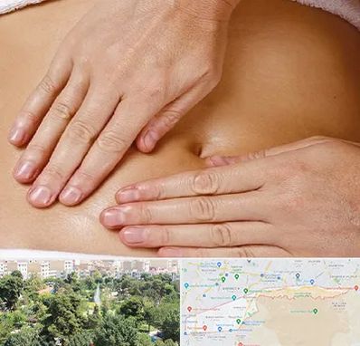 متخصص ناف گیری در منطقه 13 تهران