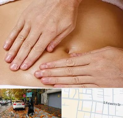 متخصص ناف گیری در خیابان فلسطین