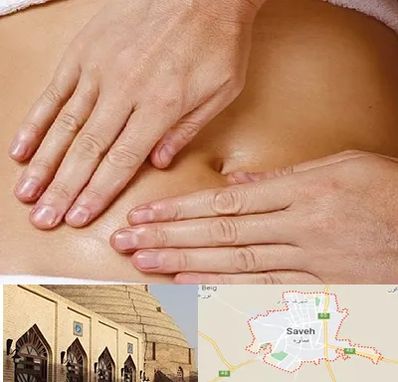 متخصص ناف گیری در ساوه