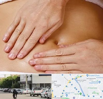 متخصص ناف گیری در قدوسی شرقی شیراز