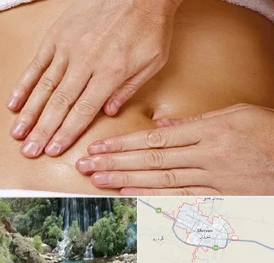 متخصص ناف گیری در شیروان
