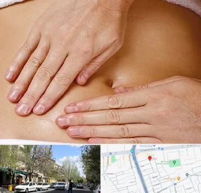 متخصص ناف گیری در کوی فیروز تبریز