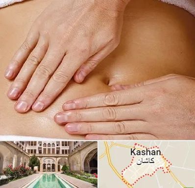 متخصص ناف گیری در کاشان