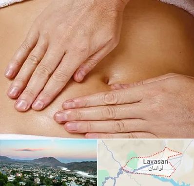 متخصص ناف گیری در لواسان