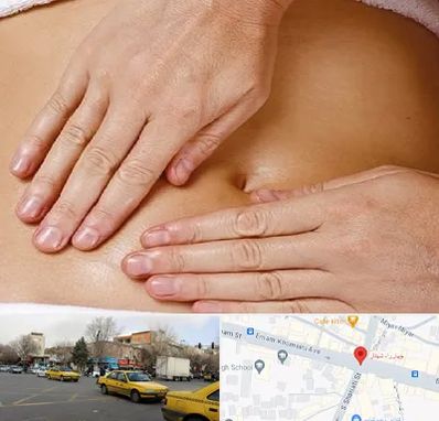 متخصص ناف گیری در شهناز تبریز