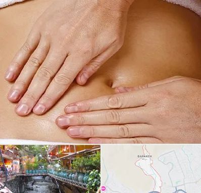 متخصص ناف گیری در درکه