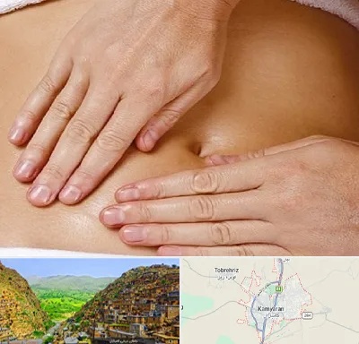 متخصص ناف گیری در کامیاران