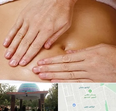 متخصص ناف گیری در کیانشهر