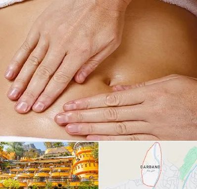 متخصص ناف گیری در دربند