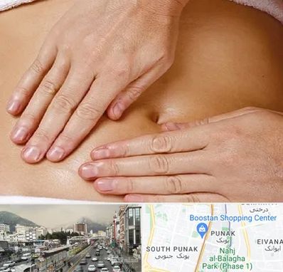 متخصص ناف گیری در پونک