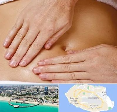 متخصص ناف گیری در کیش