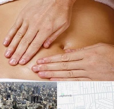 متخصص ناف گیری در جیحون