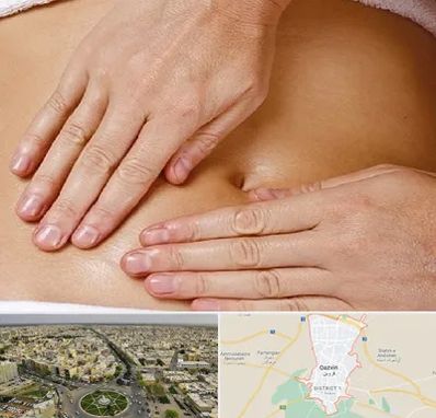 متخصص ناف گیری در قزوین