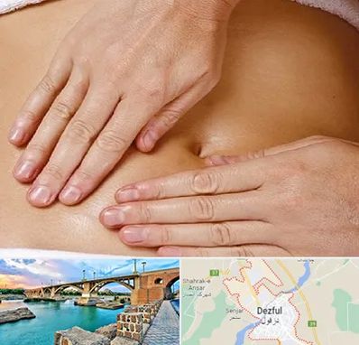 متخصص ناف گیری در دزفول