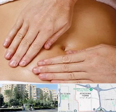 متخصص ناف گیری در آپادانا