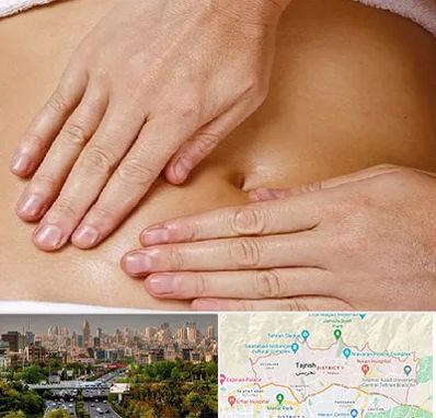 متخصص ناف گیری در منطقه 1 تهران