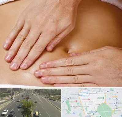 متخصص ناف گیری در منطقه 17 تهران