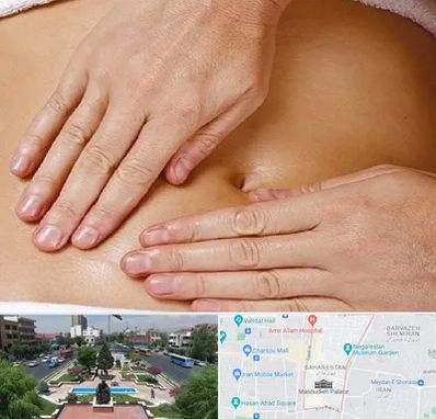 متخصص ناف گیری در بهارستان