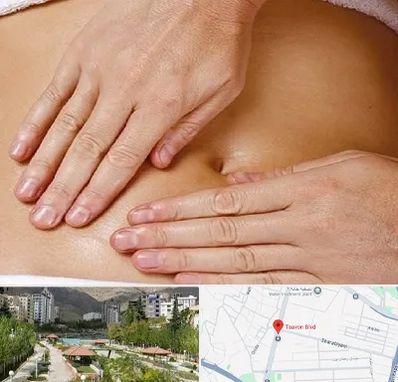متخصص ناف گیری در بلوار تعاون