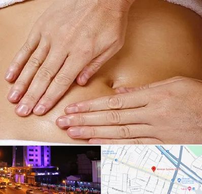 متخصص ناف گیری در آبرسان تبریز