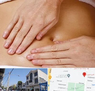 متخصص ناف گیری در افسریه