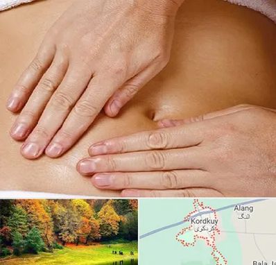 متخصص ناف گیری در کردکوی