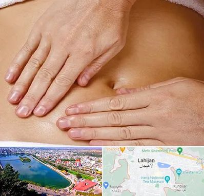 متخصص ناف گیری در لاهیجان