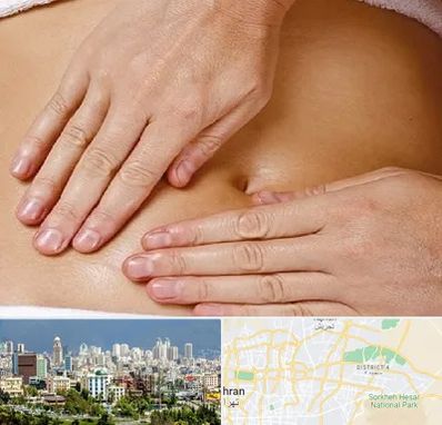 متخصص ناف گیری در شرق تهران