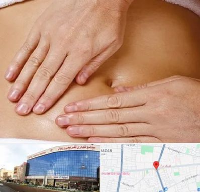 متخصص ناف گیری در نصف راه تبریز