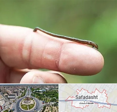 مرکز زالو درمانی در صفادشت