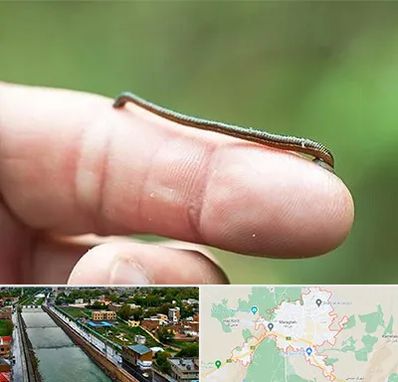 مرکز زالو درمانی در مراغه