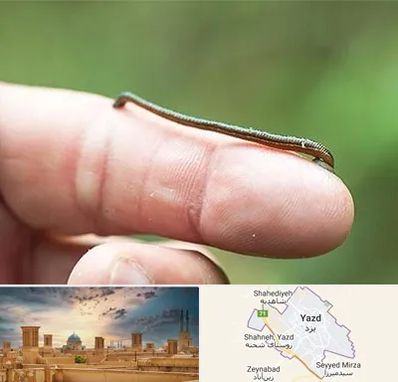 مرکز زالو درمانی در یزد