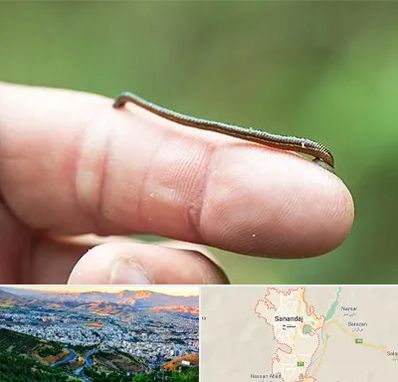 مرکز زالو درمانی در سنندج