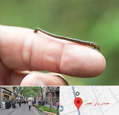 مرکز زالو درمانی در ولیعصر شهریار