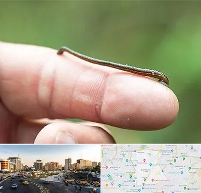 مرکز زالو درمانی در منطقه 7 تهران