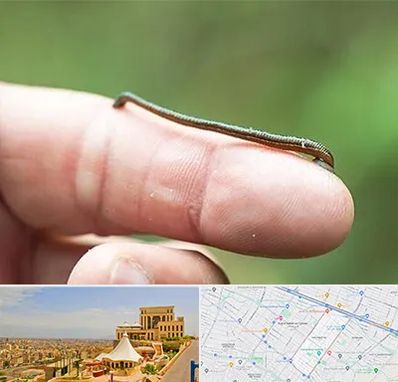 مرکز زالو درمانی در هاشمیه مشهد